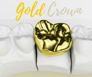 Gold Crown