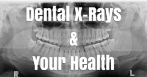 Dental X-ray